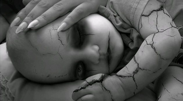 El bebé con mal&nbsp;aspecto